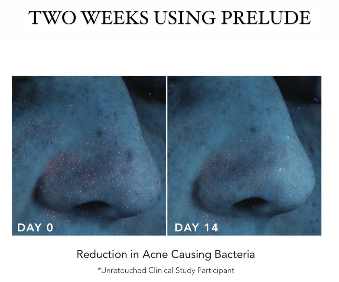 PRELUDE Facial Treament Cleanser