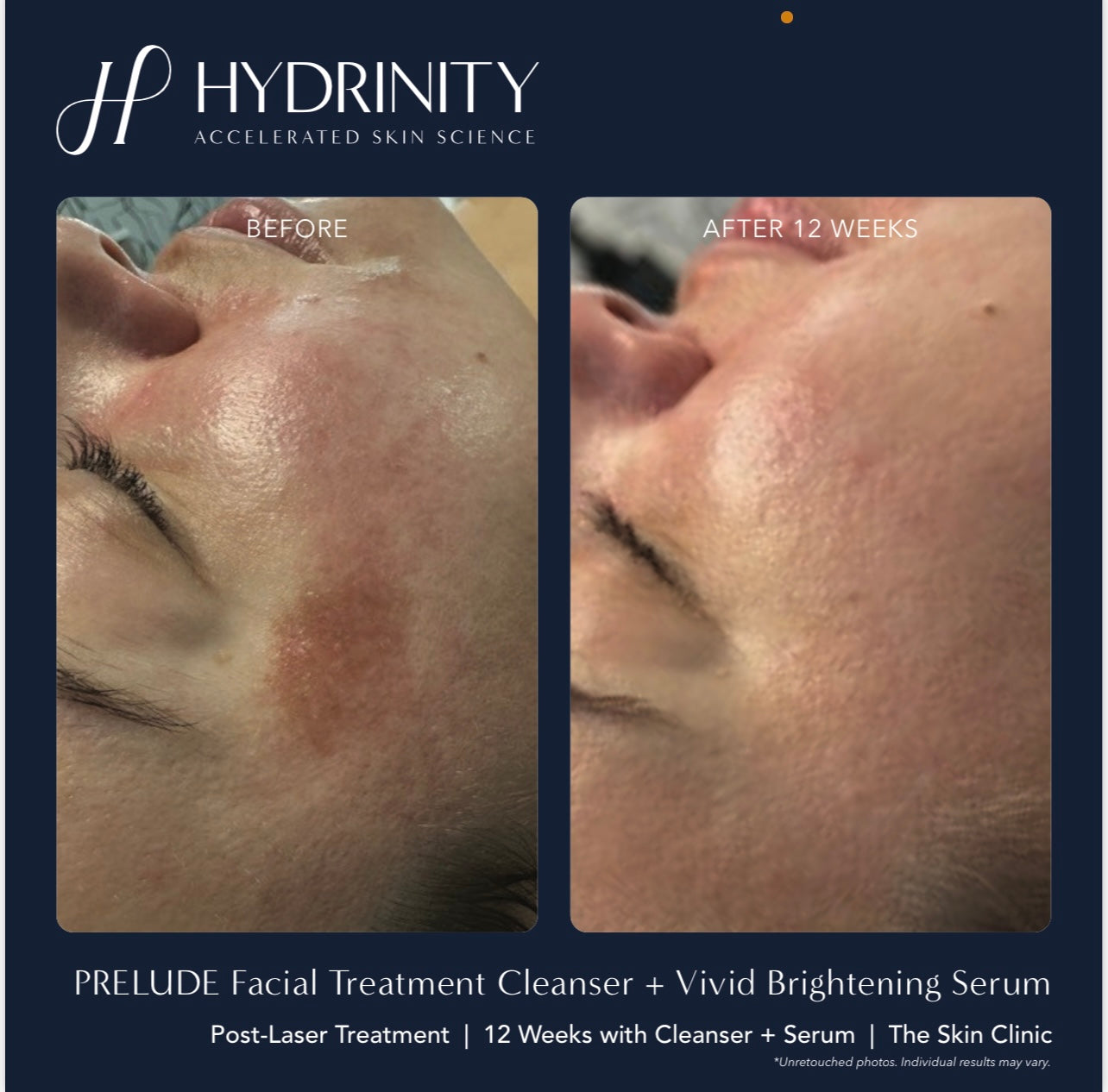 Vivid Brightening Serum