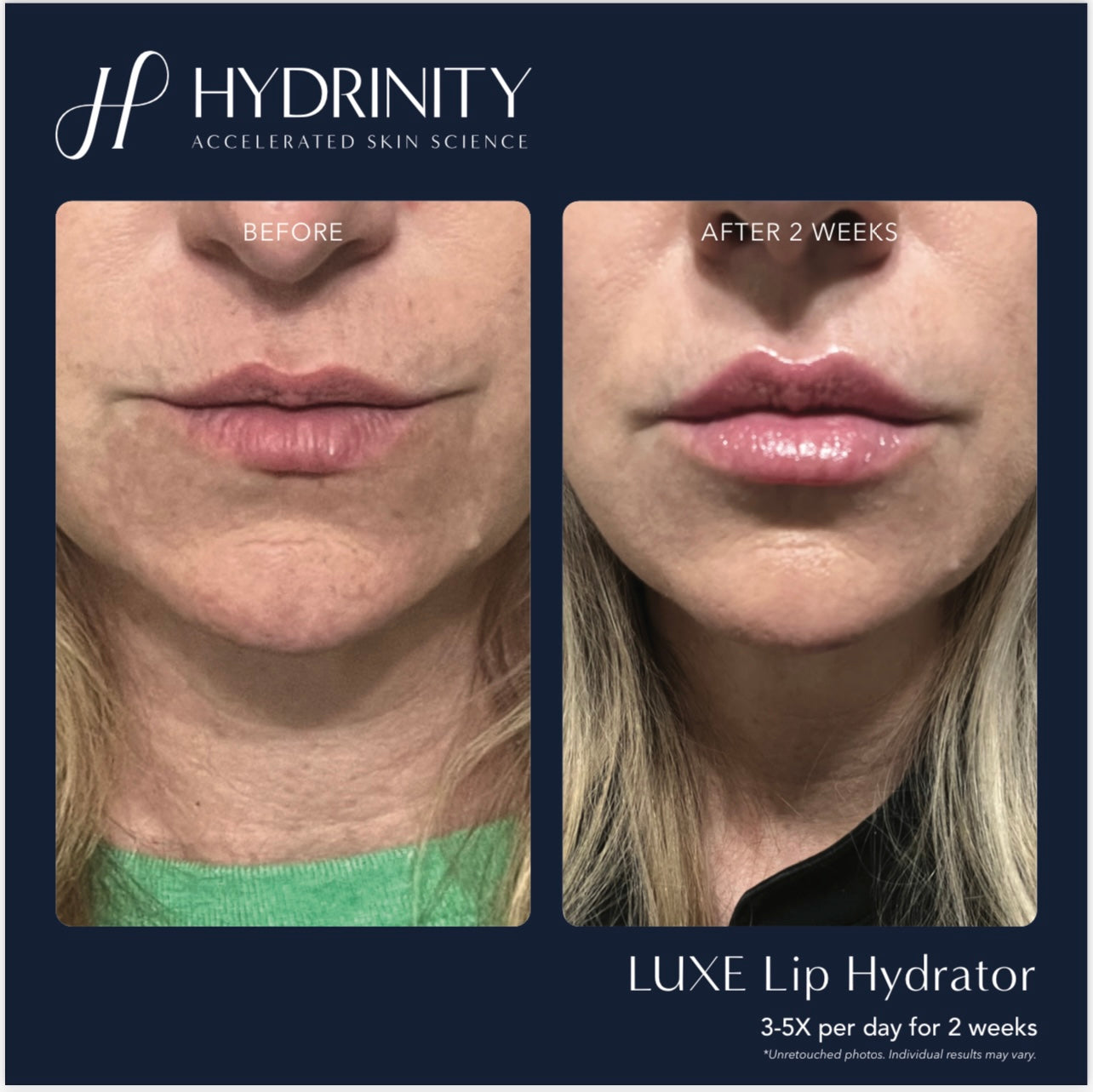 LUXE Lip Hydrator