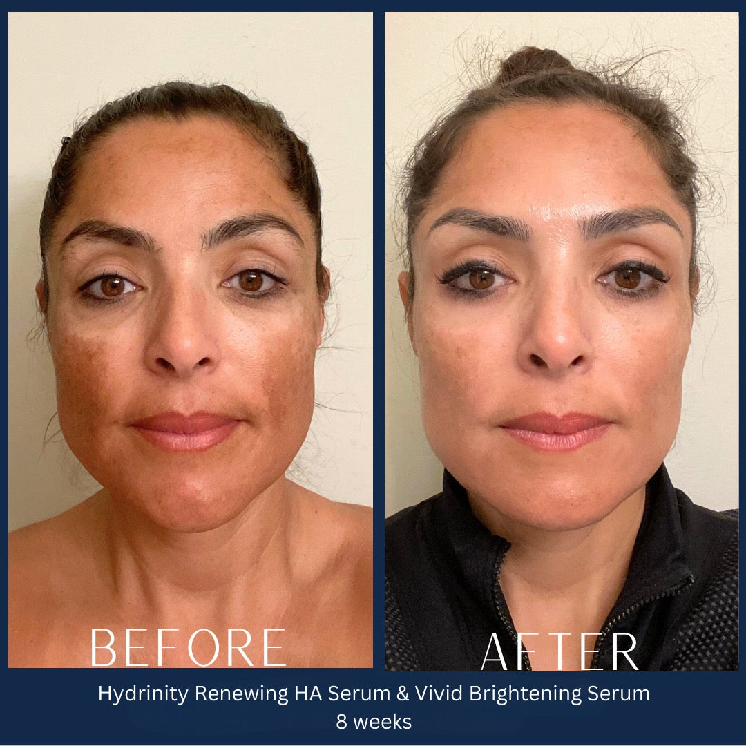 Vivid Brightening Serum