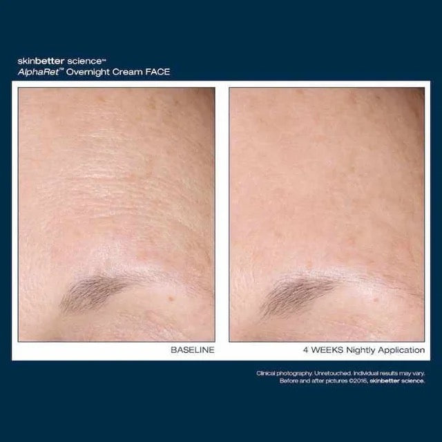 Intensive AlphaRet Overnight Cream
