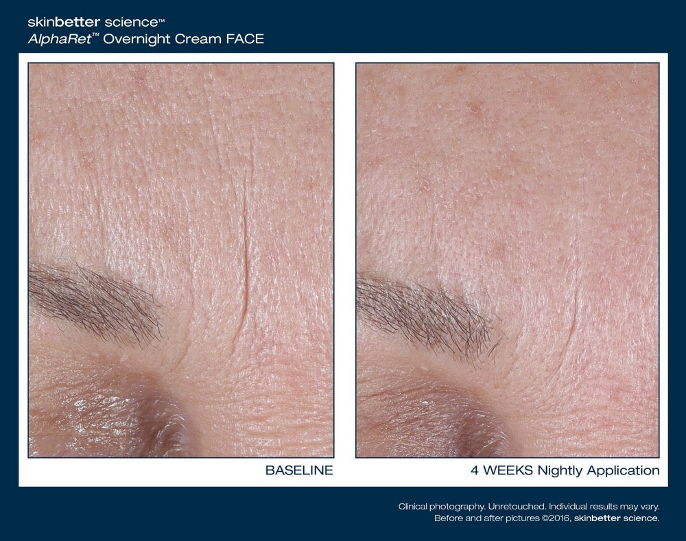 Intensive AlphaRet Overnight Cream
