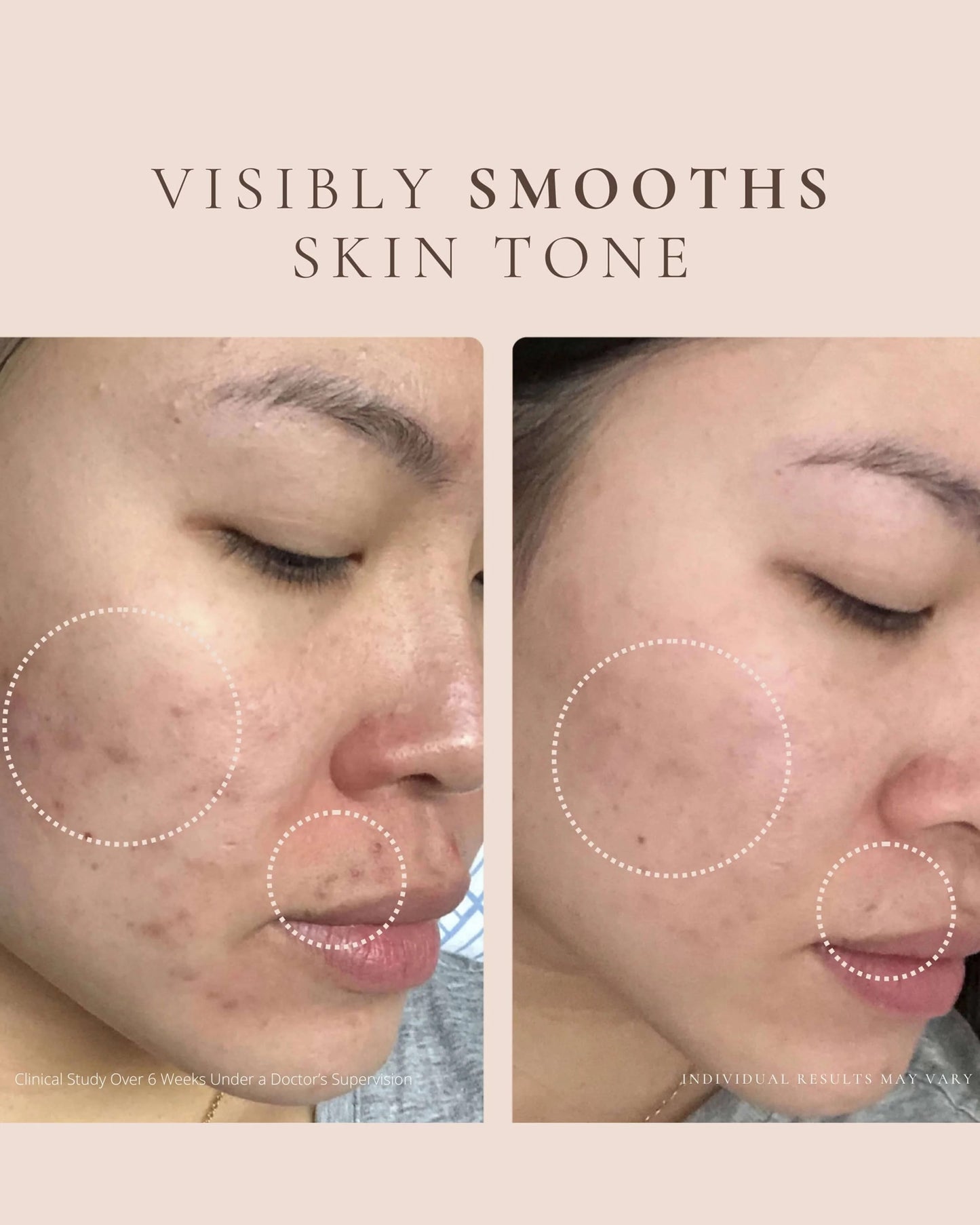 Luxury Beauty Serum - Powerful Calming Oil