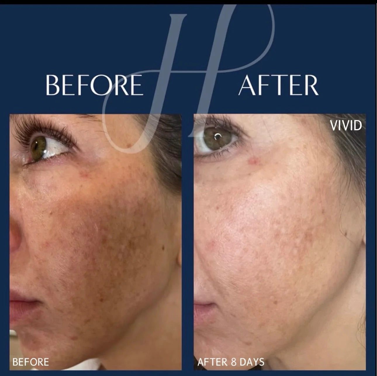 Vivid Brightening Serum