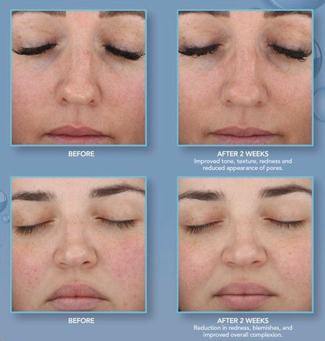 Renewing HA Serum with PPM6 Technology