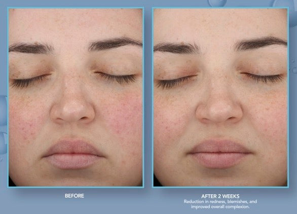 Renewing HA Serum with PPM6 Technology