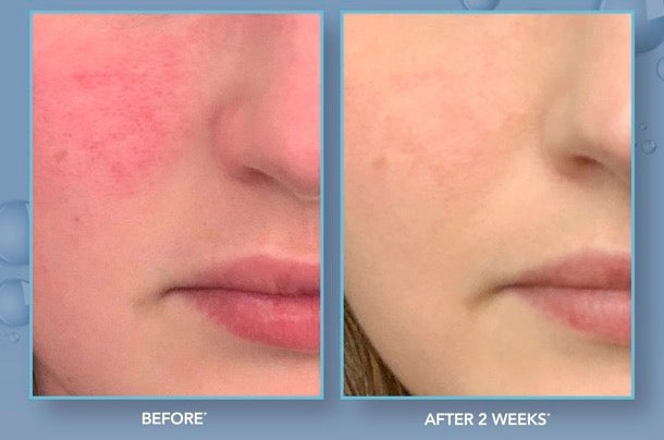 Restorative HA Serum with PPM6 Technology