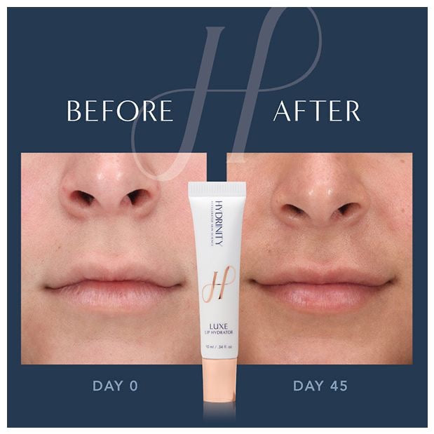 LUXE Lip Hydrator