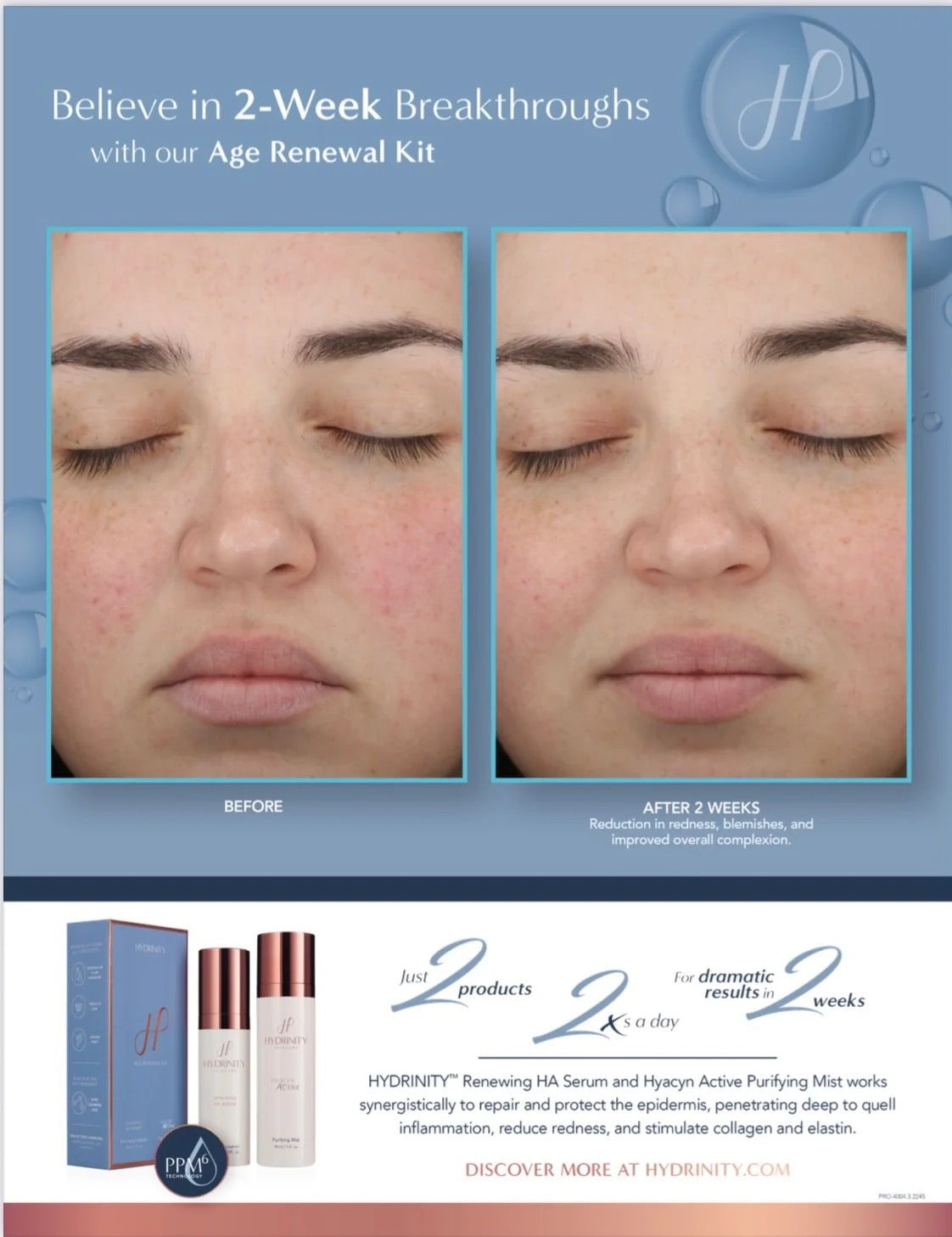 Age Renewal Kit