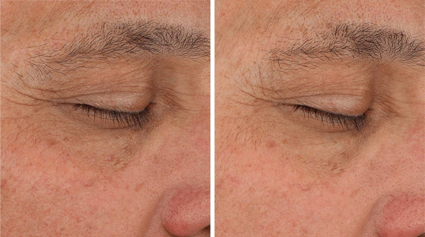 Illuminé Eye Cream