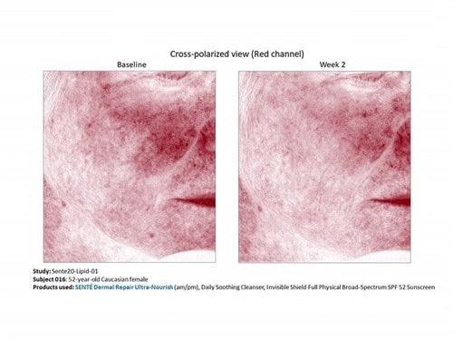 Dermal Repair Ultra-Nourish