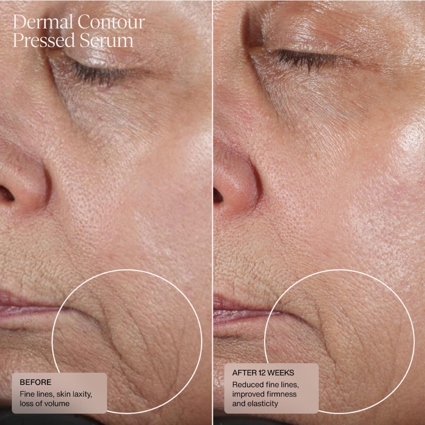 HydraFirm (Dermal Contour Pressed Serum)