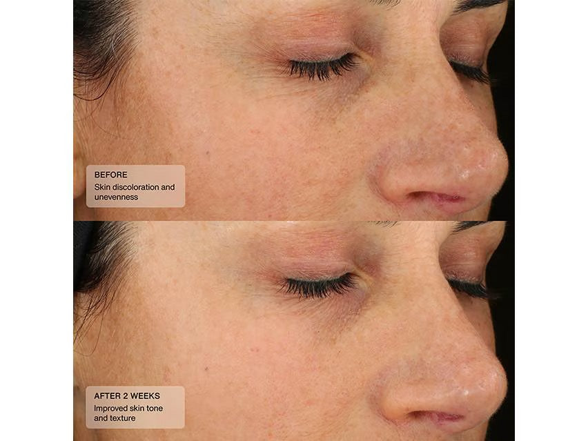 Even Tone Mineral Sunscreen