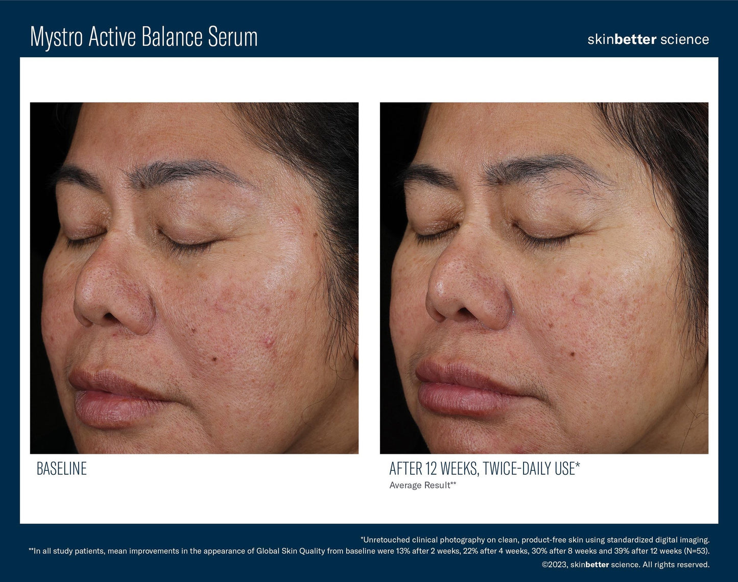 Mystro Active Balancing Serum