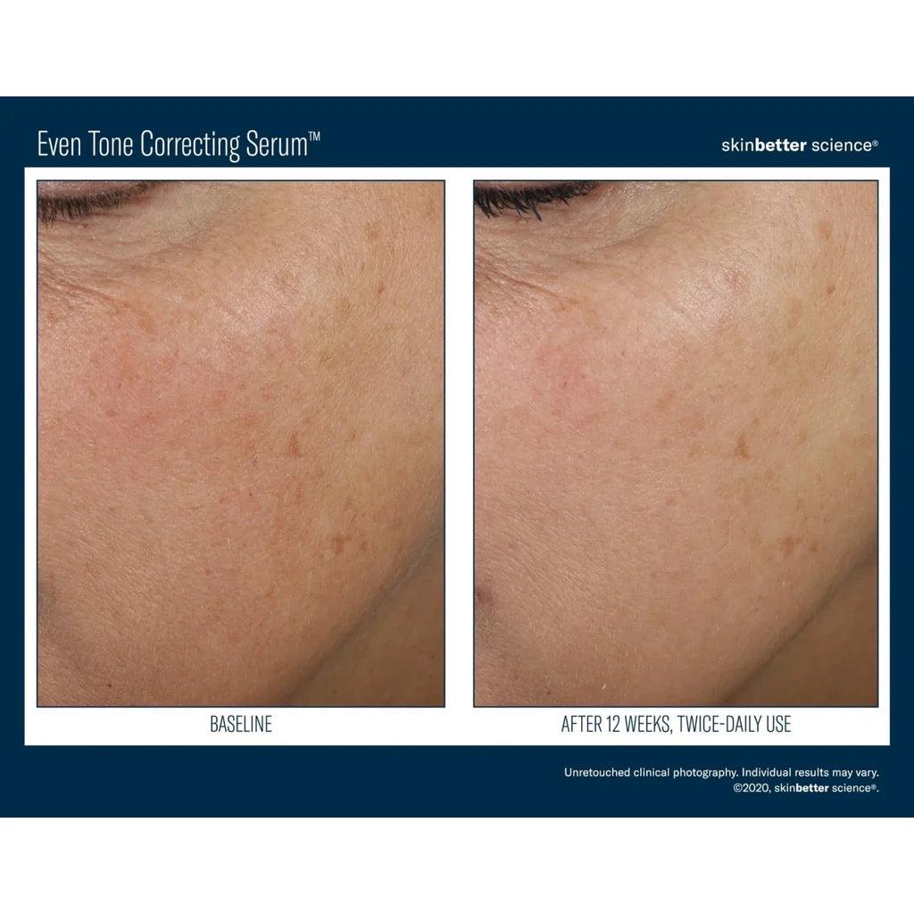 Even Tone Correcting Serum
