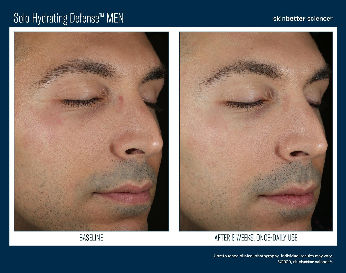 Solo Hydrating Defense MEN