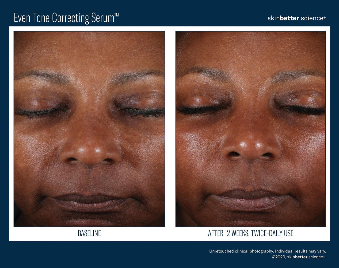 Even Tone Correcting Serum