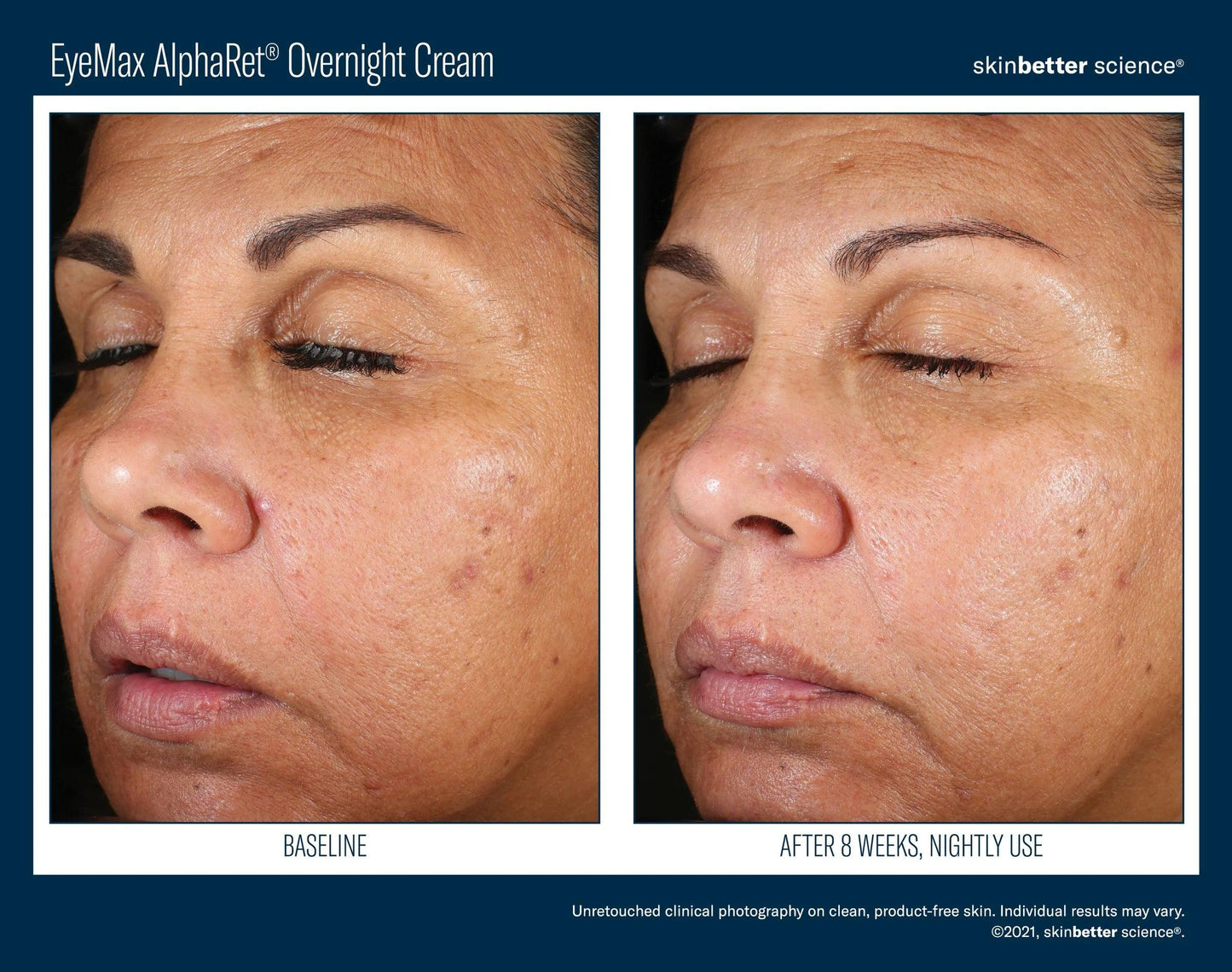EyeMax AlphaRet Overnight Cream