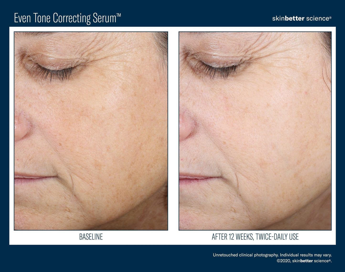 Even Tone Correcting Serum