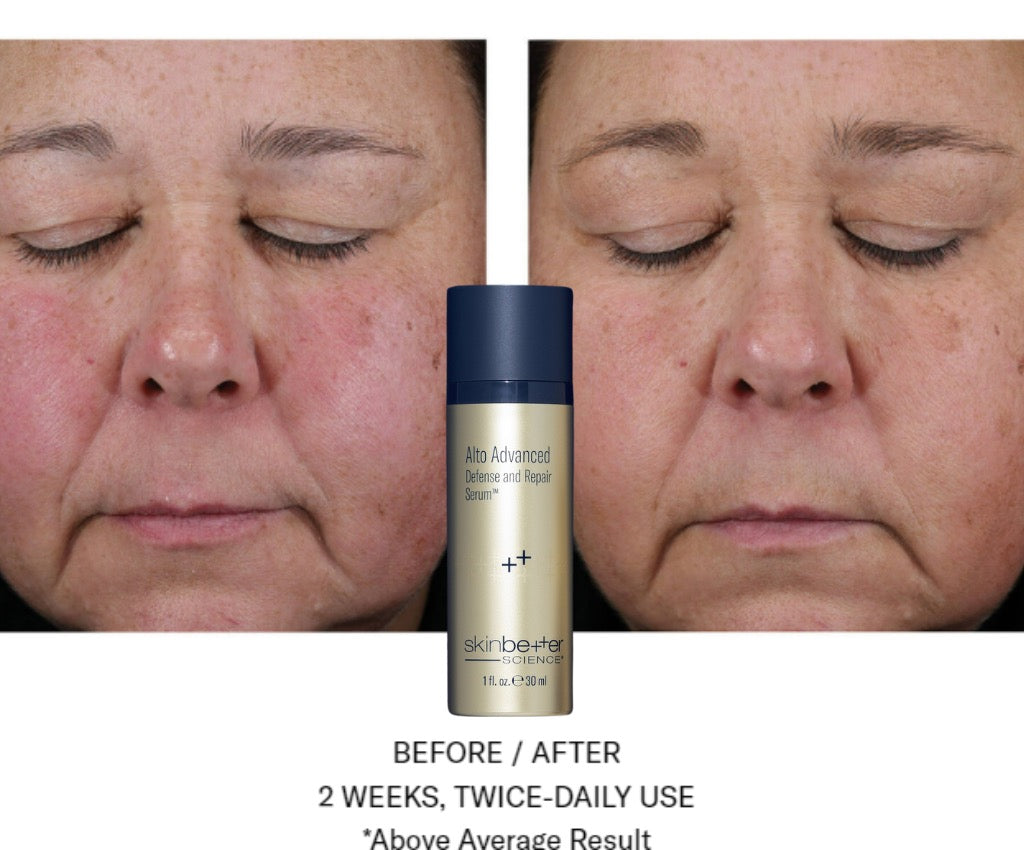 Alto Advanced Antioxidant Defense & Repair Serum