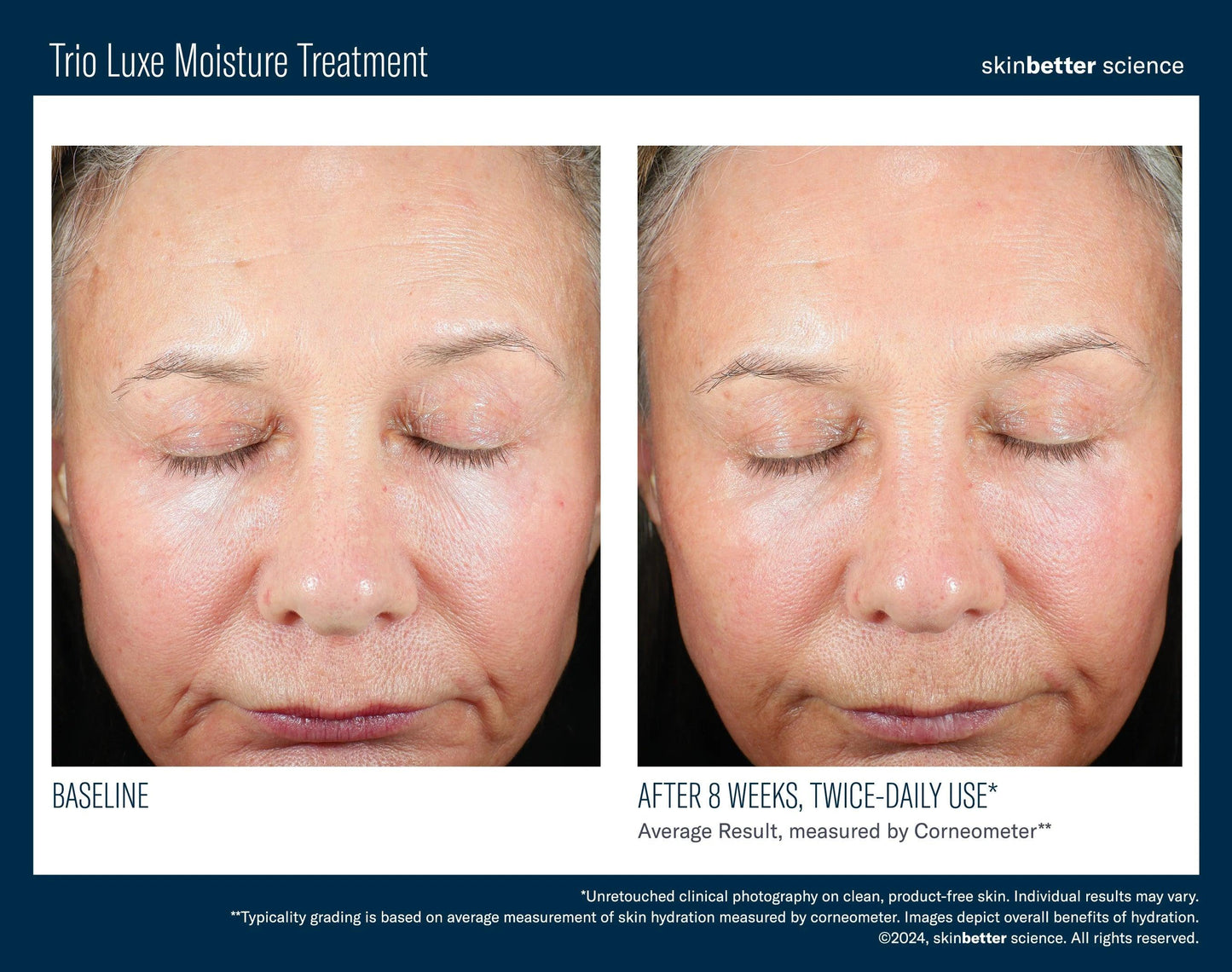 Trio Luxe Moisture Treatment