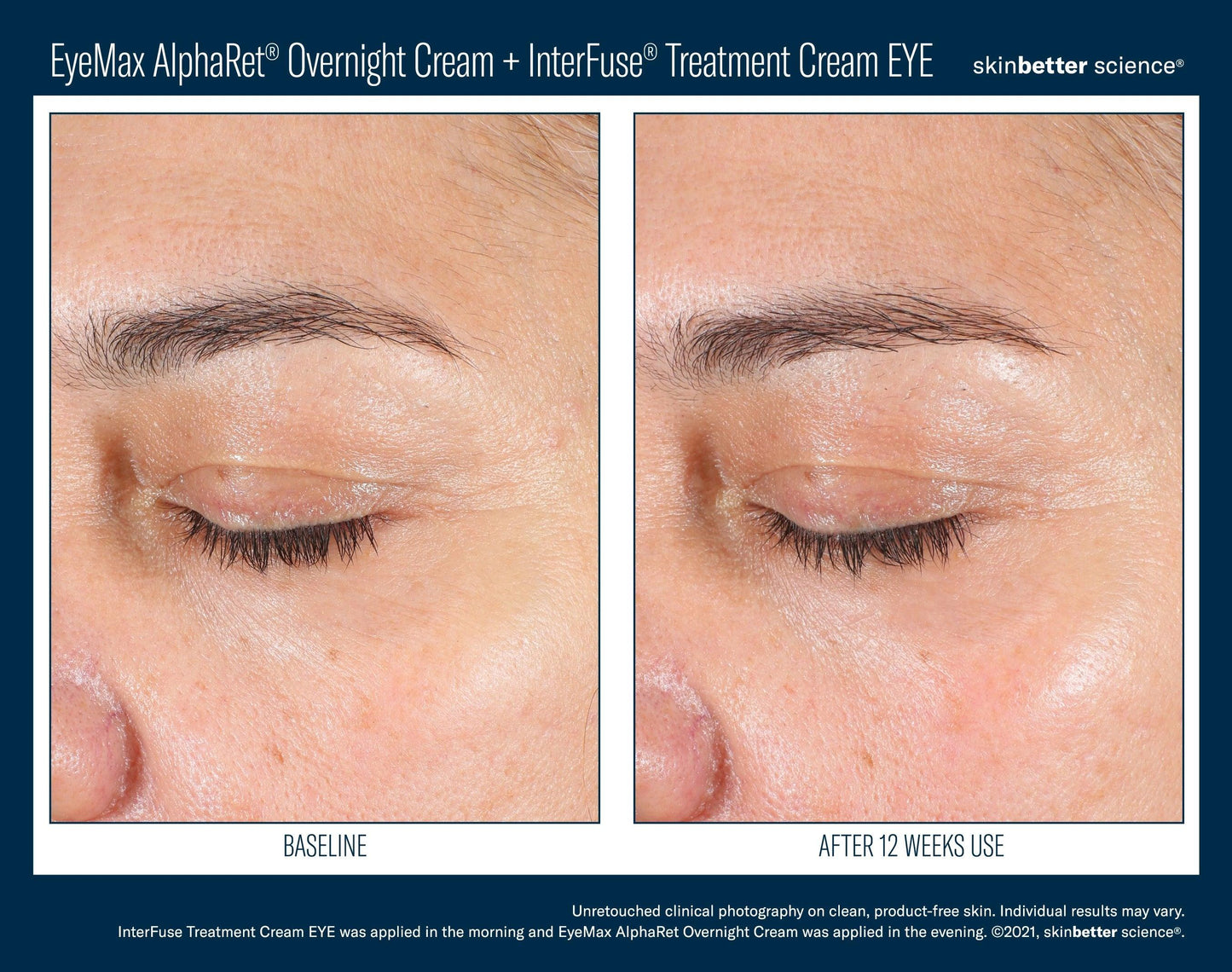 EyeMax AlphaRet Overnight Cream