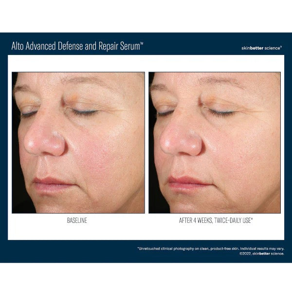 Alto Advanced Antioxidant Defense & Repair Serum