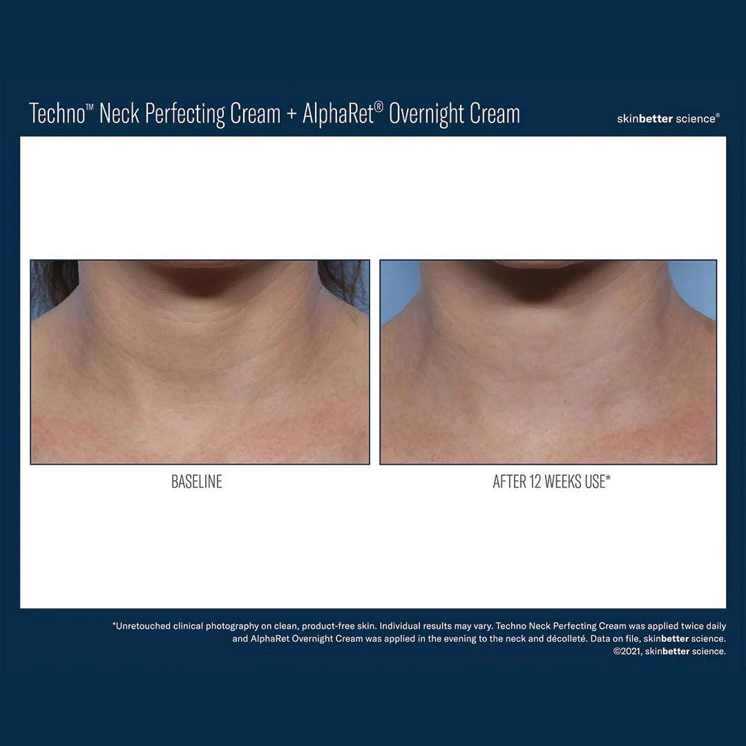 Techno Neck Perfecting Cream