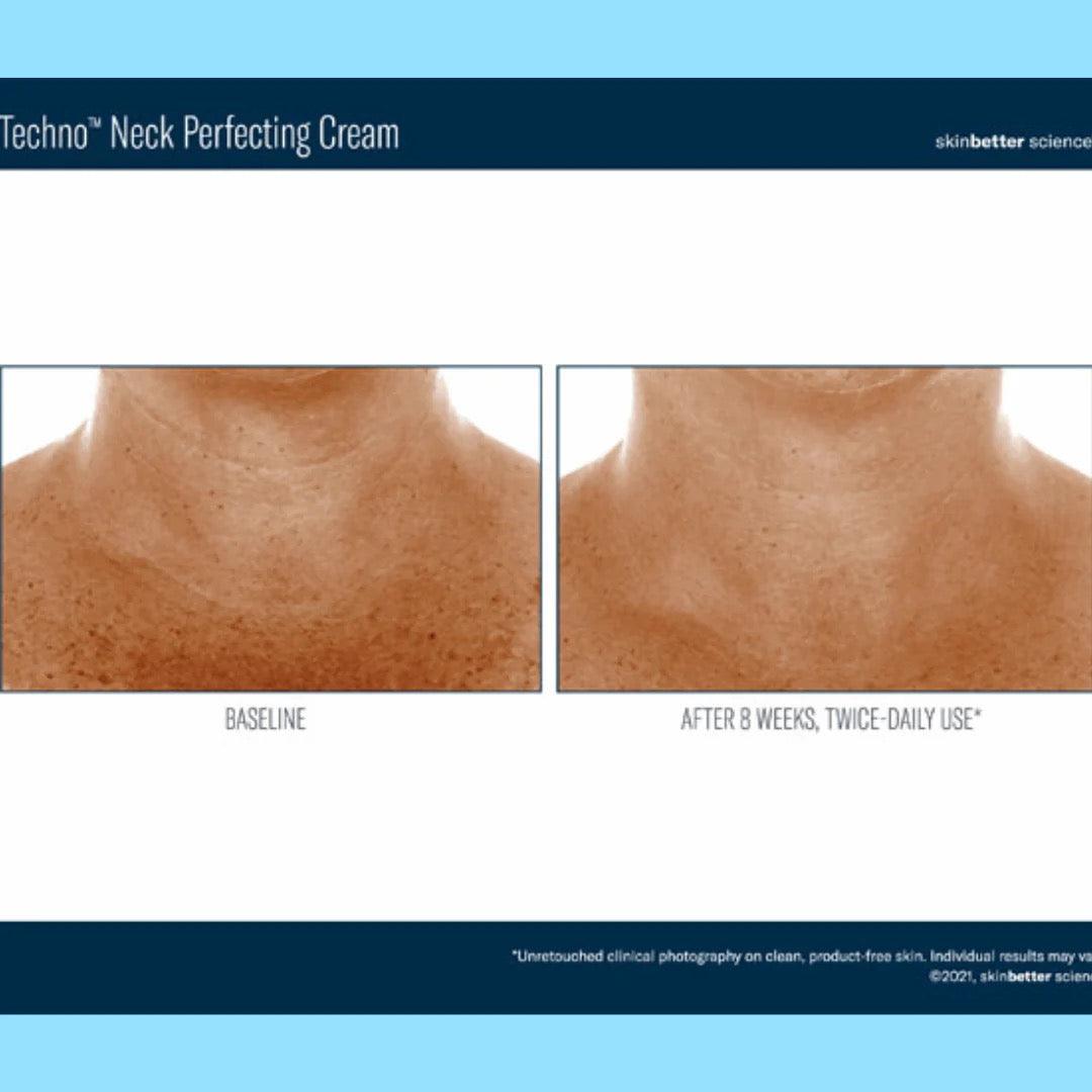 Techno Neck Perfecting Cream