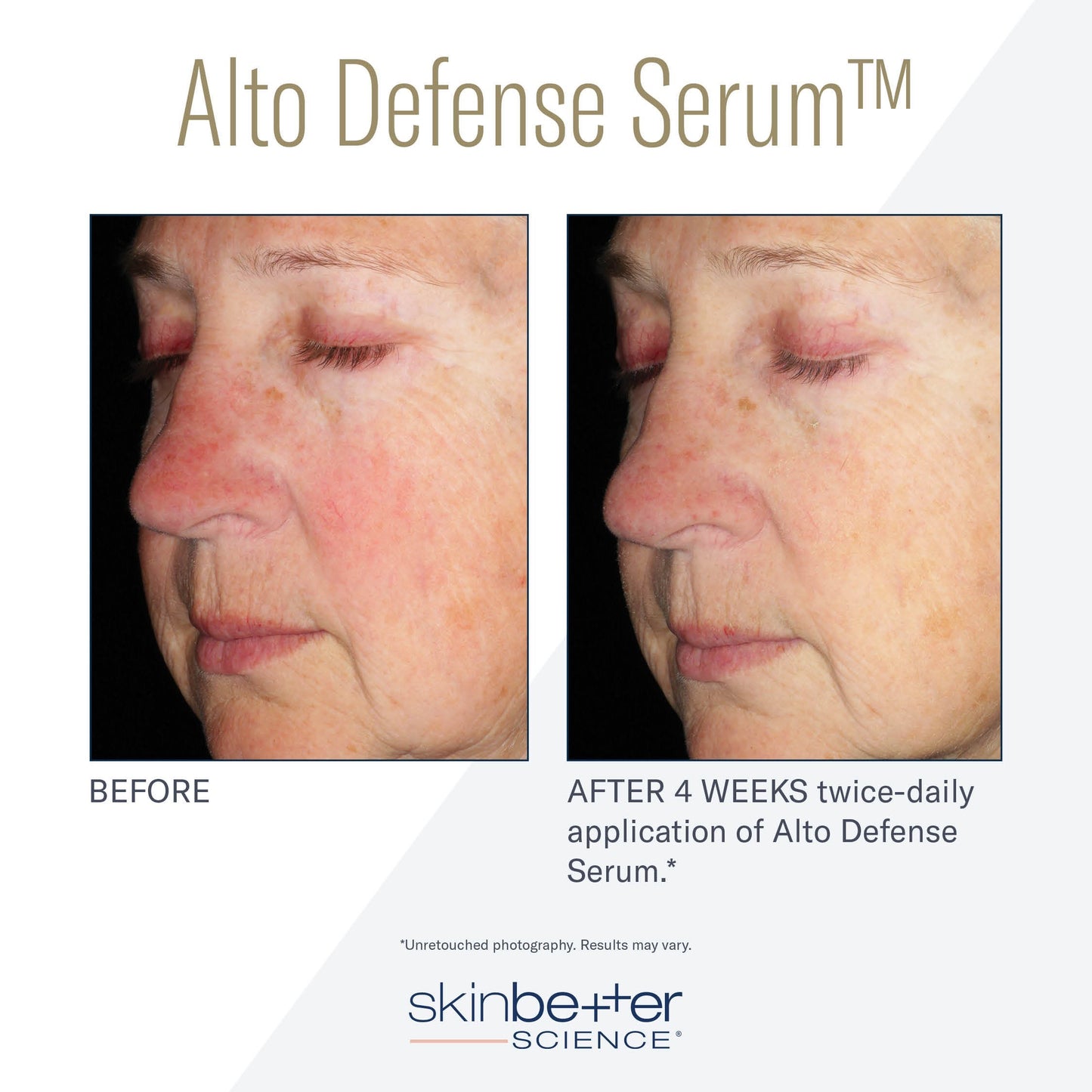 Alto Defense Serum