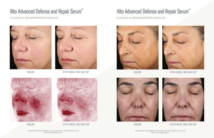 Alto Advanced Antioxidant Defense & Repair Serum