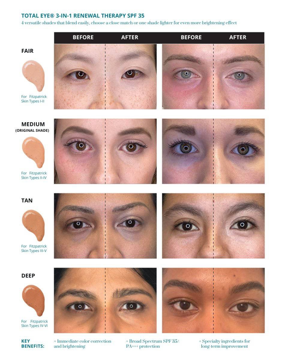 Total Eye® 3-in-1 Renewal Therapy SPF 35