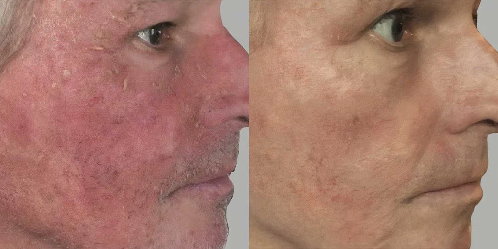 Growth Factor Serum MD
