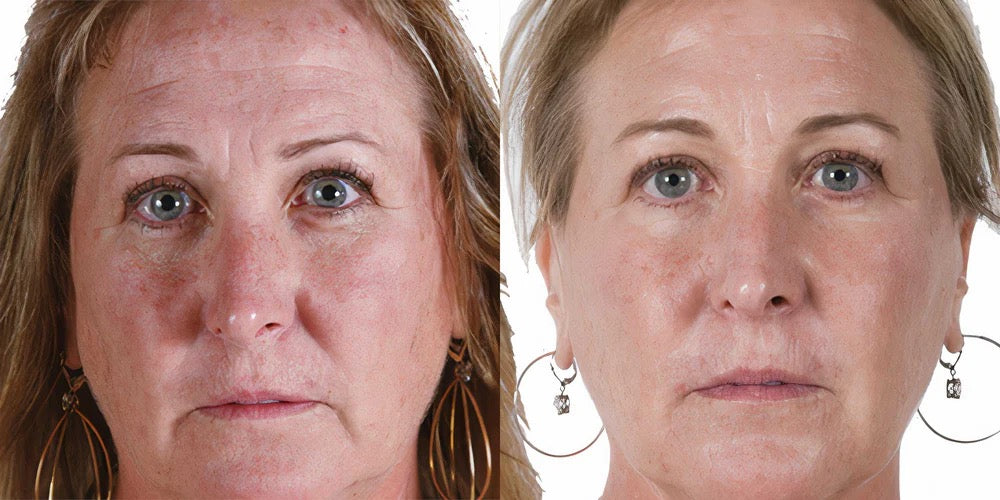 Growth Factor Serum MD