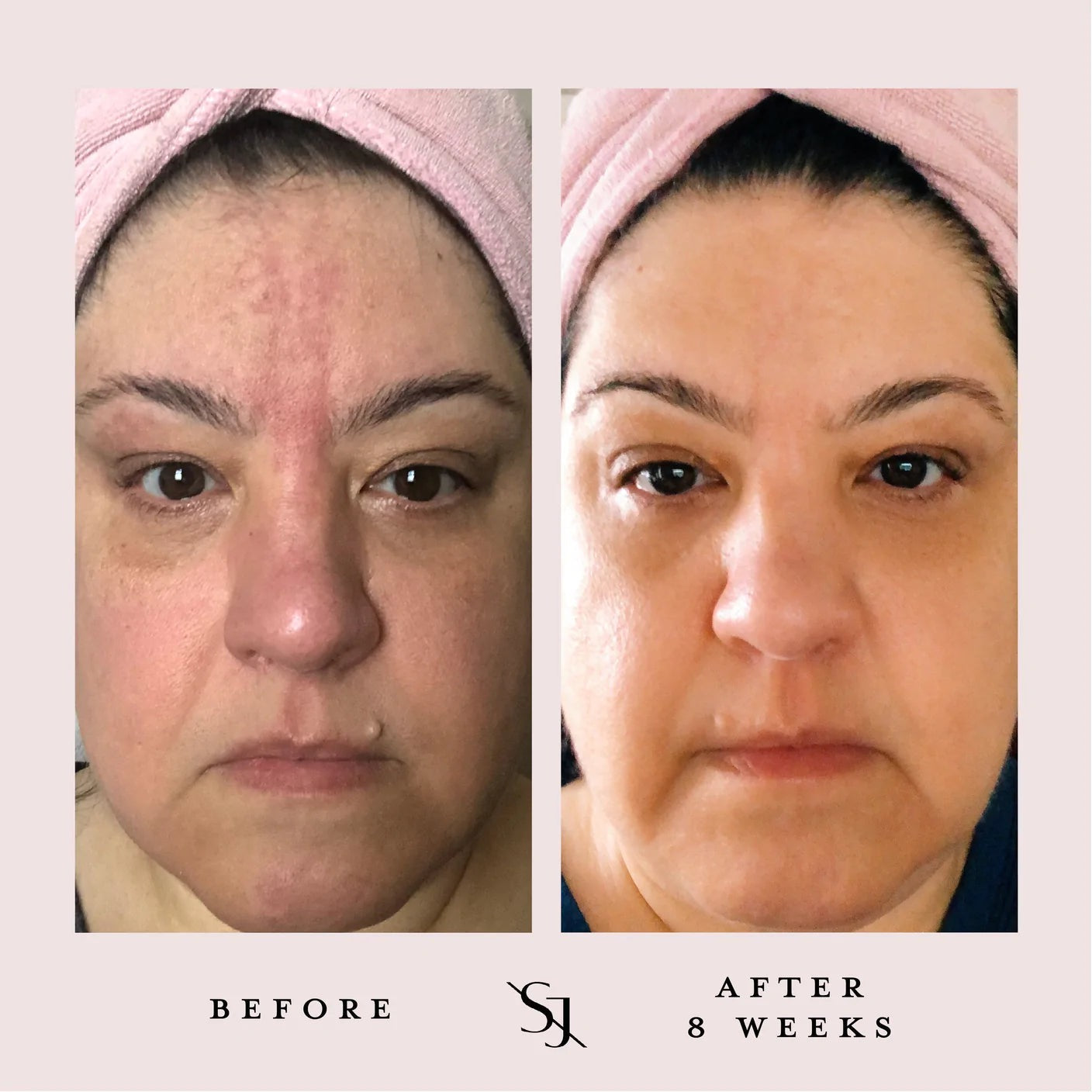 Luxury Beauty Serum - Powerful Calming Oil