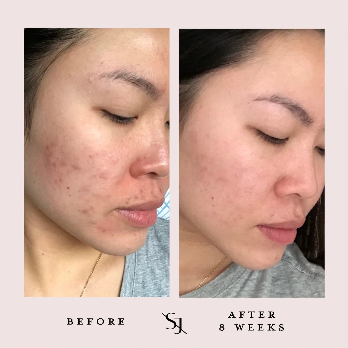 Luxury Beauty Serum - Powerful Calming Oil