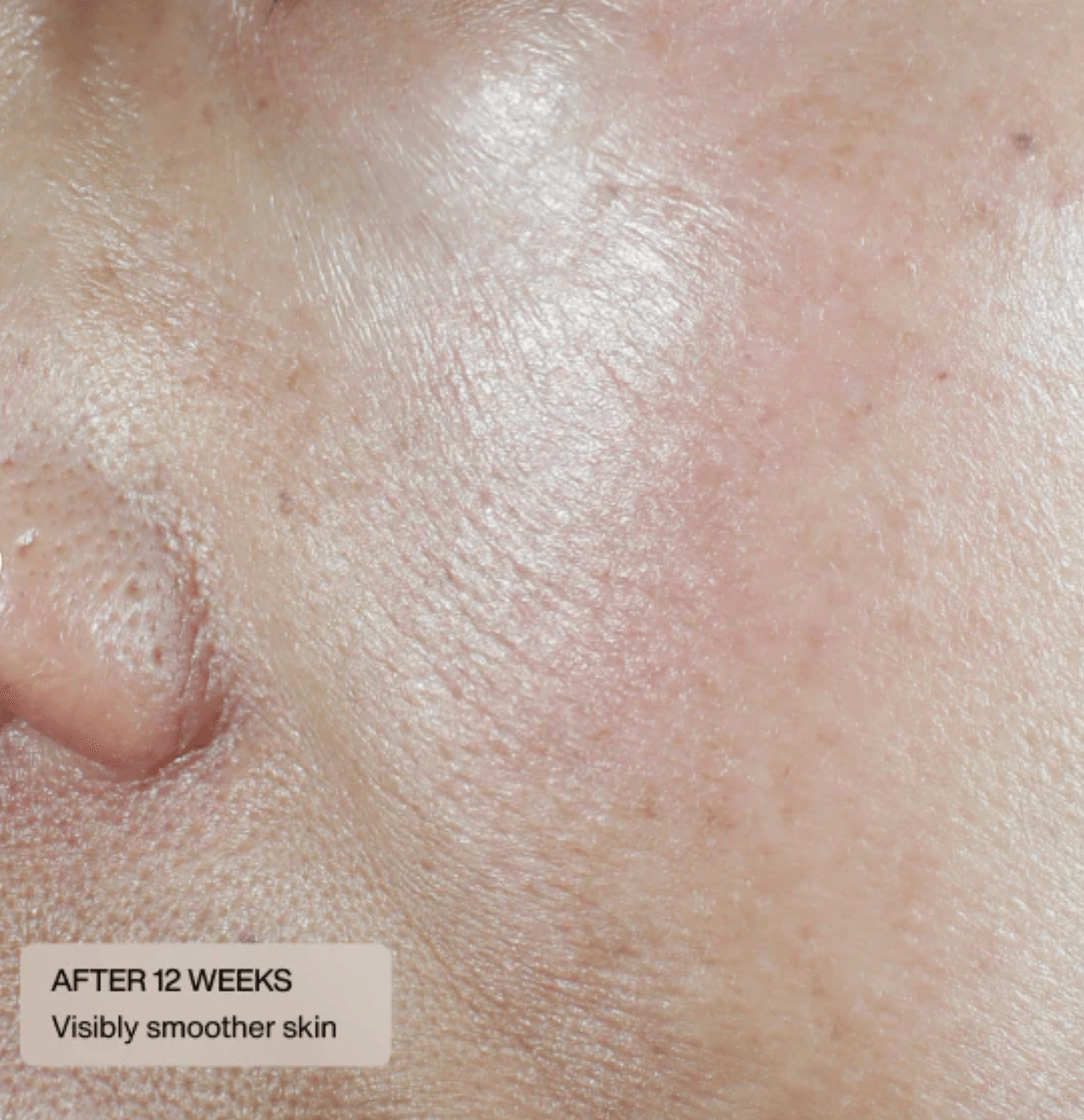 Dermal Repair Ultra-Nourish