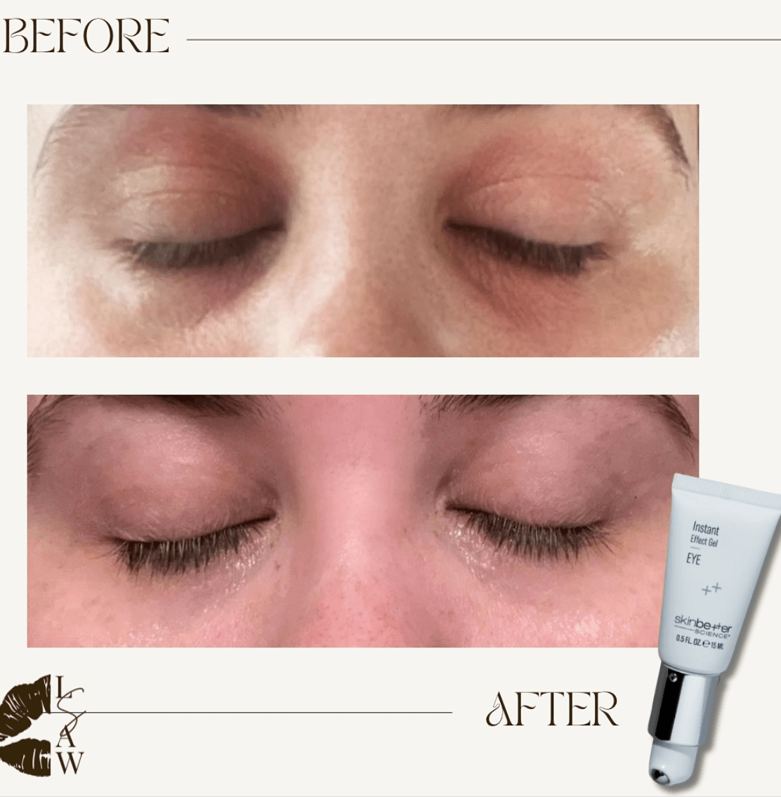 Instant Effect Gel EYE