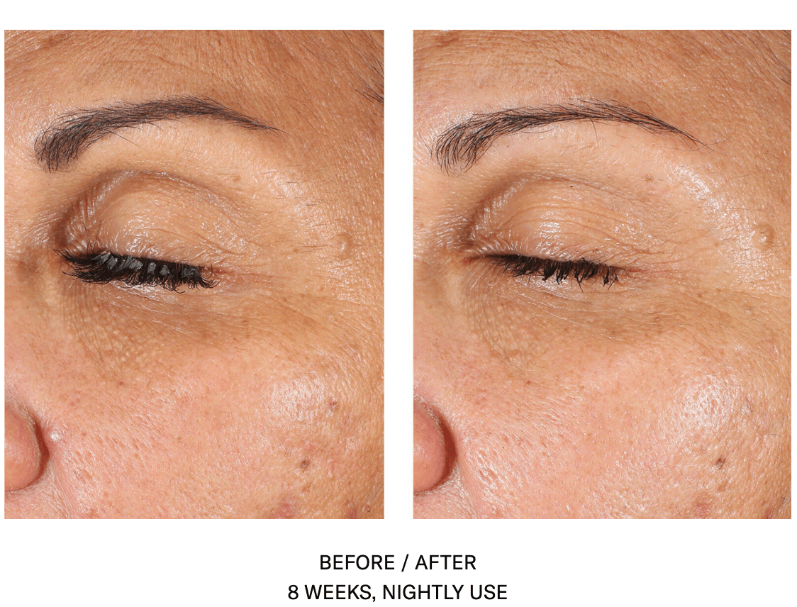 EyeMax AlphaRet Overnight Cream