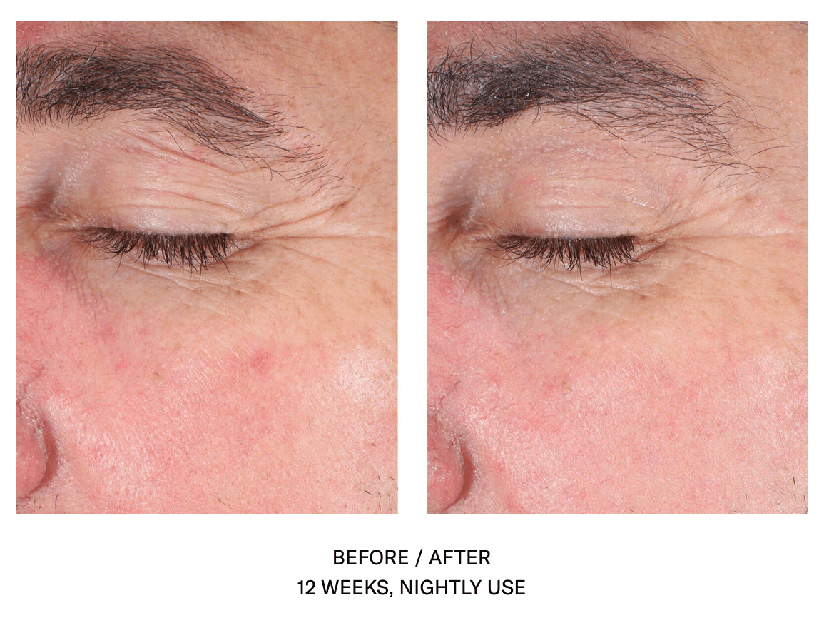 EyeMax AlphaRet Overnight Cream