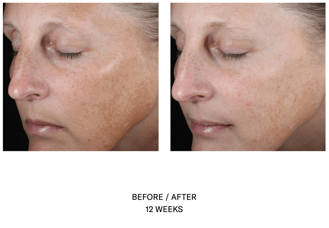Even Tone Correcting Serum