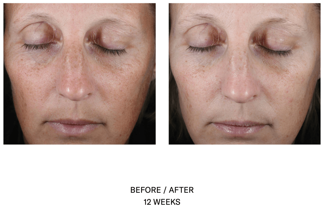 Even Tone Correcting Serum