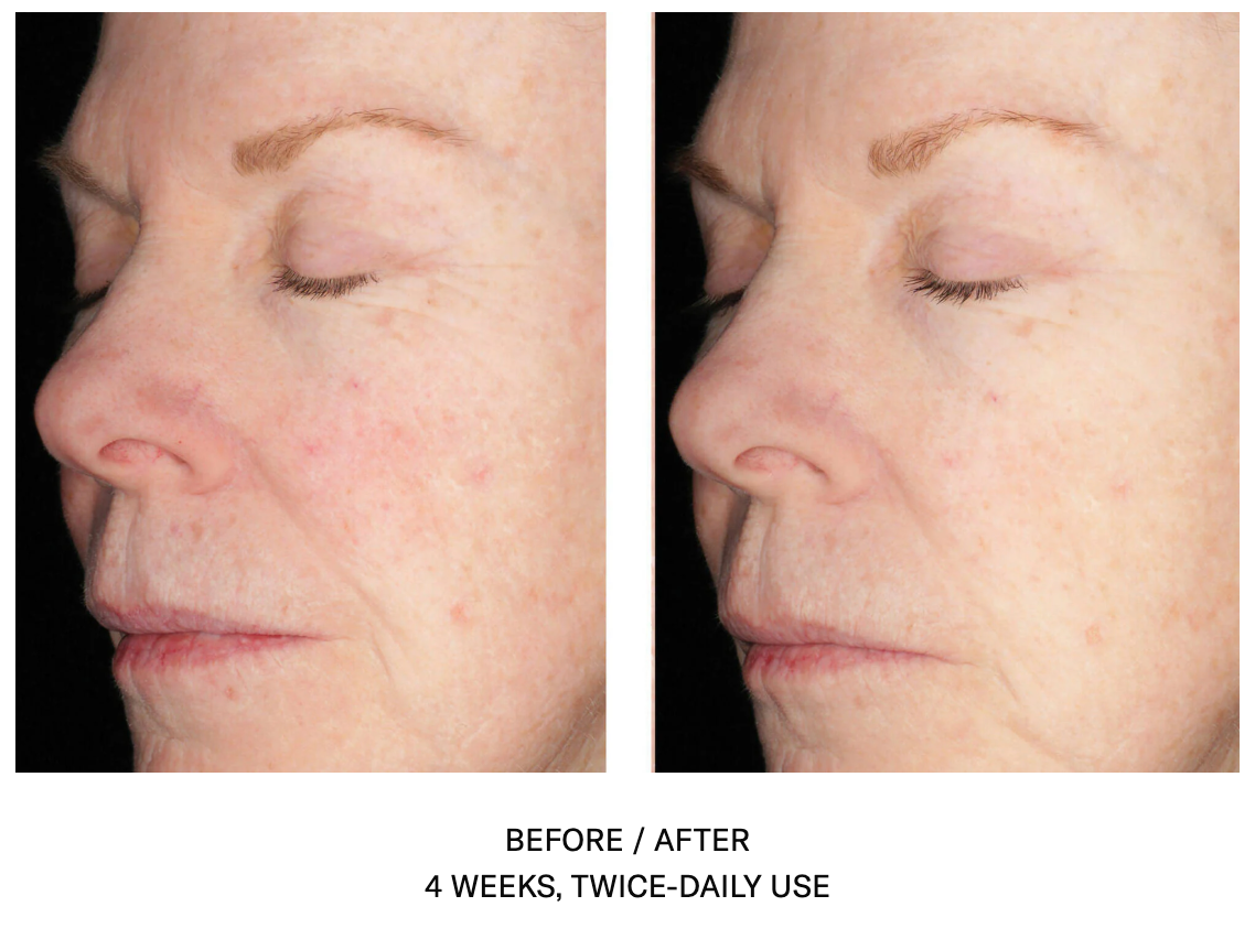 Alto Defense Serum