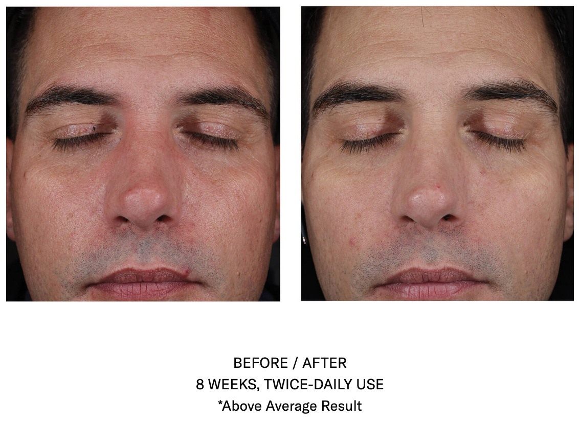 Mystro Active Balancing Serum