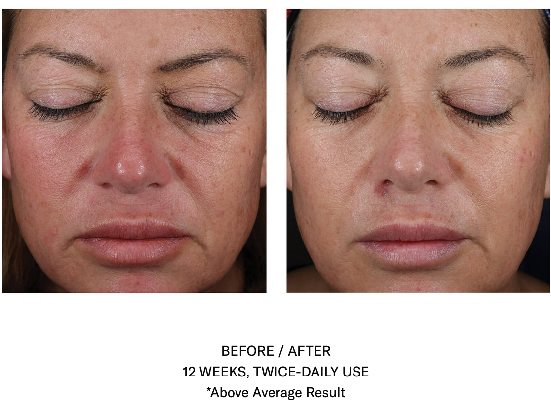 Mystro Active Balancing Serum