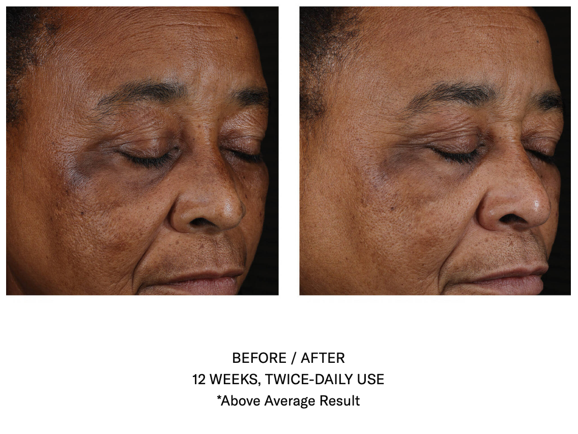 Mystro Active Balancing Serum