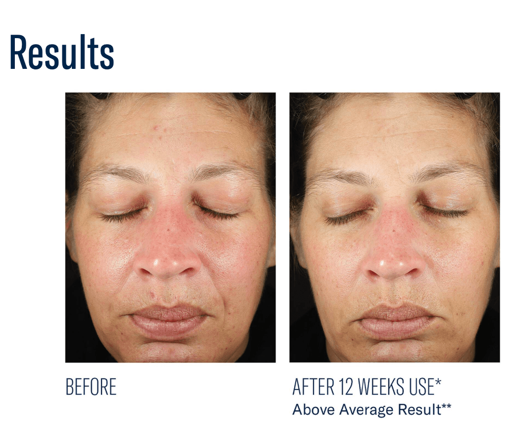 BioRewind - Skin Health Dietary Supplement