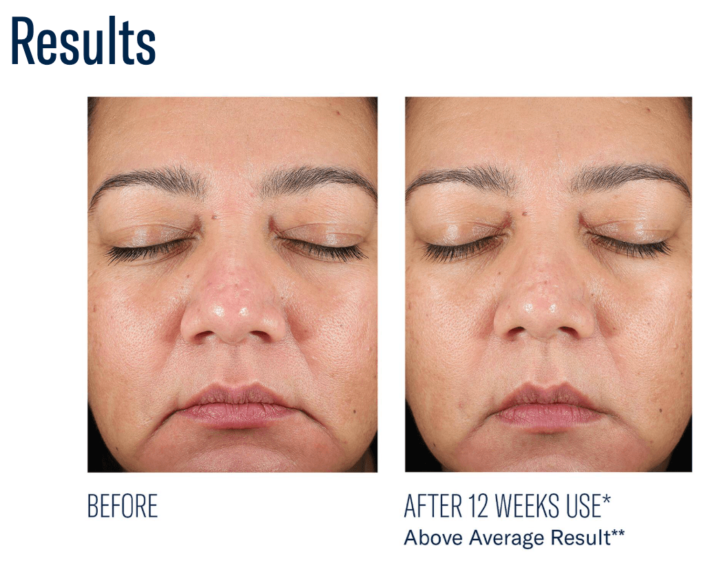 BioRewind - Skin Health Dietary Supplement