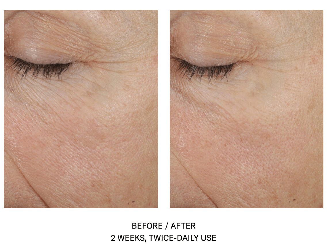 Trio Rebalancing Moisture Treatment