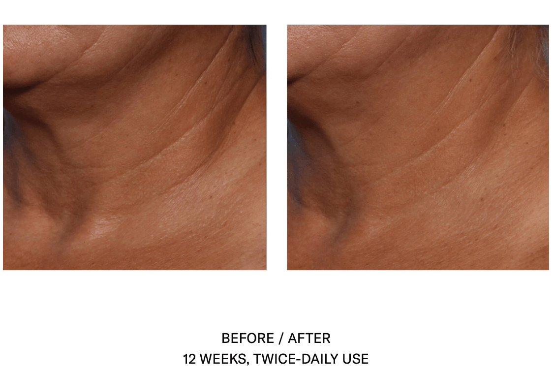 Techno Neck Perfecting Cream